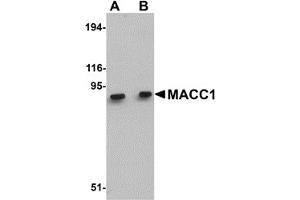 Western Blotting (WB) image for anti-Metastasis Associated in Colon Cancer 1 (MACC1) (Middle Region) antibody (ABIN1030992) (MACC1 抗体  (Middle Region))