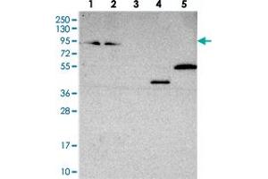 Western blot analysis of Lane 1: RT-4, Lane 2: U-251 MG, Lane 3: Human Plasma, Lane 4: Liver, Lane 5: Tonsil with ZNF235 polyclonal antibody  at 1:250-1:500 dilution. (ZNF235 抗体)