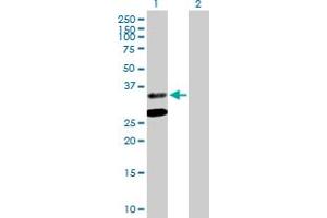 Western Blot analysis of ASPA expression in transfected 293T cell line by ASPA MaxPab polyclonal antibody. (ASPA 抗体  (AA 1-313))