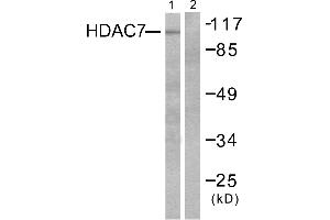 Western blot analysis of extracts from HuvEc cells, using HDAC7 antibody (#C0227). (HDAC7 抗体)