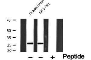 Western blot analysis of extracts of various tissue sample,using Granzyme B Antibody .