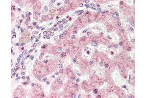 Human, Liver: Formalin-Fixed Paraffin-Embedded (FFPE). (MXD4 抗体  (N-Term))
