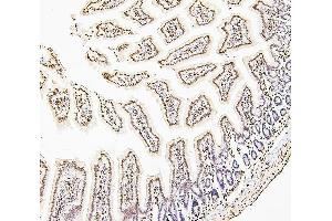 IHC analysis of H1F0 using anti-H1F0 antibody (ABIN7600521).