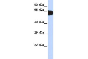 WB Suggested Anti-TBX18 Antibody Titration: 0.