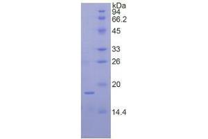 SDS-PAGE analysis of Human Ribonuclease A7 Protein.