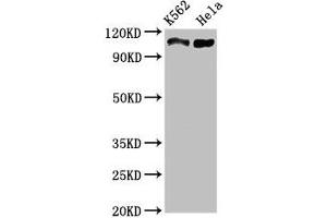Western Blot Positive WB detected in: K562 whole cell lysate, Hela whole cell lysate All lanes: C16orf62 antibody at 3 μg/mL Secondary Goat polyclonal to rabbit IgG at 1/50000 dilution Predicted band size: 110, 94 kDa Observed band size: 110 kDa (C16orf62 抗体  (AA 6-205))