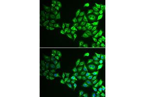 Immunofluorescence analysis of HeLa cell using CREB3 antibody. (CREB3 抗体)