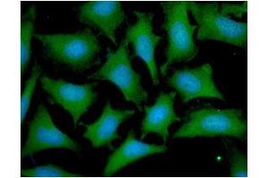 ICC/IF analysis of OTUB1 in HeLa cells line, stained with DAPI (Blue) for nucleus staining and monoclonal anti-human OTUB1 antibody (1:100) with goat anti-mouse IgG-Alexa fluor 488 conjugate (Green). (OTUB1 抗体  (AA 1-271))