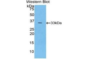 Detection of Recombinant PYGB, Human using Polyclonal Antibody to Glycogen Phosphorylase, Brain (PYGB) (PYGB 抗体  (AA 477-731))