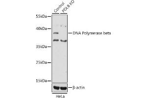 Western Blotting (WB) image for anti-Polymerase (DNA Directed), beta (POLB) (AA 1-335) antibody (ABIN3022385)
