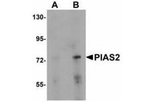 Image no. 1 for anti-Protein Inhibitor of Activated STAT, 2 (PIAS2) (N-Term) antibody (ABIN478291) (PIAS2 抗体  (N-Term))