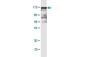 Western Blot detection against Immunogen (143 KDa) . (Vinculin 抗体  (AA 1-1066))