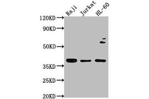 Western Blot Positive WB detected in: Raji whole cell lysate, Jurkat whole cell lysate, HL-60 whole cell lysate All lanes: RASSF2 antibody at 1:2000 Secondary Goat polyclonal to rabbit IgG at 1/50000 dilution Predicted band size: 38, 18 kDa Observed band size: 38 kDa (RASSF2 抗体  (AA 69-326))