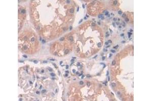 IHC-P analysis of Human Tissue, with DAB staining. (Peroxiredoxin 2 抗体  (AA 6-164))