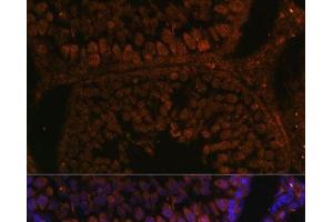 Immunofluorescence analysis of Rat testis using TPD52L3 Polyclonal Antibody at dilution of 1:100. (TPD52L3 抗体)