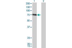 Western Blot analysis of CSF1 expression in transfected 293T cell line by CSF1 monoclonal antibody (M01), clone 1A9. (M-CSF/CSF1 抗体  (AA 33-132))