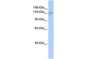 Image no. 1 for anti-Zinc Finger, MYND-Type Containing 8 (ZMYND8) (AA 36-85) antibody (ABIN6742514)