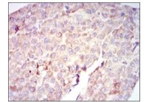 Immunohistochemistry (IHC) image for anti-V-Raf-1 Murine Leukemia Viral Oncogene Homolog 1 (RAF1) antibody (ABIN1108823) (RAF1 抗体)