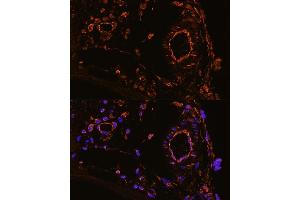 Immunofluorescence (IF) image for anti-Y Box Binding Protein 1 (YBX1) (AA 100-200) antibody (ABIN6150328)