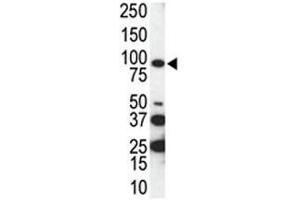 Western blot analysis of AXL antibody and SKBR3 cell lysate. (AXL 抗体  (AA 863-894))