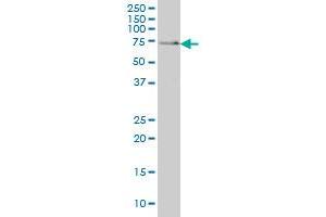 SH3BP2 monoclonal antibody (M01), clone 1E9 Western Blot analysis of SH3BP2 expression in A-431 . (SH3BP2 抗体  (AA 452-561))