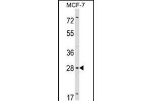 Western blot analysis of RASL11B Antibody in MCF-7 cell line lysates (35ug/lane) (RASL11B 抗体  (N-Term))