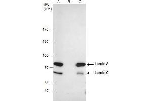 IP Image Lamin A + C antibody immunoprecipitates Lamin A + C protein in IP experiments. (Lamin A/C 抗体)