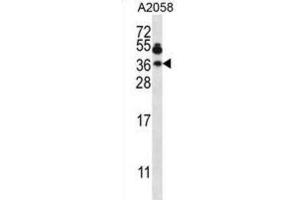 Western Blotting (WB) image for anti-Vesicle-Associated Membrane Protein 7 (VAMP7) antibody (ABIN2997586) (VAMP7 抗体)