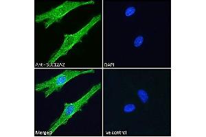 ABIN570824 Immunofluorescence analysis of paraformaldehyde fixed HeLa cells, permeabilized with 0. (SLC12A2 抗体  (Internal Region))