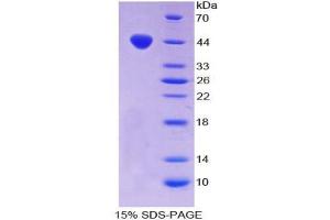 SDS-PAGE analysis of Mouse Chemerin Protein. (Chemerin 蛋白)