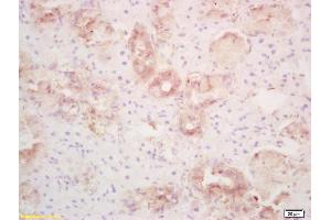 Formalin-fixed and paraffin embedded rat thyroid labeled with Rabbit Anti PLRP1/PNLIPRP1 Polyclonal Antibody, Unconjugated (ABIN718826) at 1:200 followed by conjugation to the secondary antibody and DAB staining
