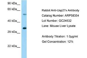 Western Blotting (WB) image for anti-Ubiquitin Specific Peptidase 27, X-Linked (USP27X) (Middle Region) antibody (ABIN2787648) (USP27X 抗体  (Middle Region))