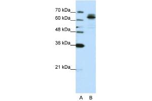 FXR1 antibody used at 0. (FXR1 抗体  (C-Term))