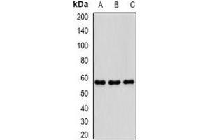 Western blot analysis of PDE1B expression in THP1 (A), mouse brain (B), mouse spleen (C) whole cell lysates. (PDE1B 抗体)