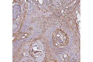 IHC analysis of ITGAV using anti-ITGAV antibody (ABIN7602396).