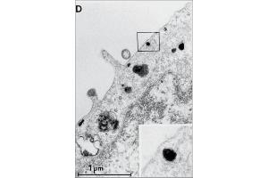 Electron microscopic image of internalized EGF-R/antibody-complexes in A431 cells. (EGFR 抗体  (Extracellular, non Ligand Binding Domain))