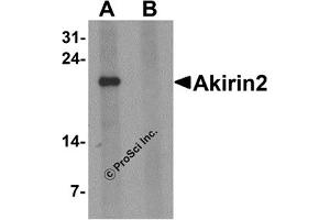 Western Blotting (WB) image for anti-Akirin 2 (AKIRIN2) (Middle Region 1) antibody (ABIN1031185) (AKIRIN2 抗体  (Middle Region 1))