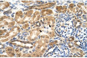 Immunohistochemistry (IHC) image for anti-Glucosaminyl (N-Acetyl) Transferase 3, Mucin Type (GCNT3) (C-Term) antibody (ABIN2781304)