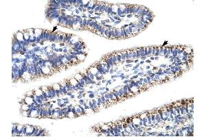 KLHL13 antibody was used for immunohistochemistry at a concentration of 4-8 ug/ml to stain Epithelial cells of intestinal villus (arrows) in Human Intestine. (KLHL13 抗体  (N-Term))
