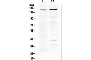 Western Blotting (WB) image for anti-ATP-Binding Cassette, Sub-Family B (MDR/TAP), Member 1 (ABCB1) antibody (ABIN5693064) (ABCB1 抗体)