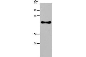 Western Blot analysis of Human fetal brain tissue using FADS1 Polyclonal Antibody at dilution of 1:300 (FADS1 抗体)