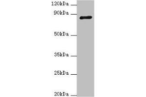 Western blot All lanes: ADAM33 antibody at 4 μg/mL + NIH/3T3 whole cell lysate Secondary Goat polyclonal to rabbit IgG at 1/10000 dilution Predicted band size: 88, 85, 33 kDa Observed band size: 88 kDa (ADAM33 抗体  (AA 140-420))