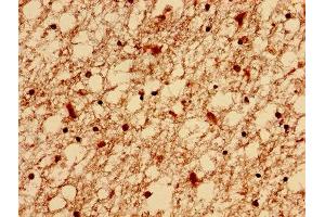 Immunohistochemistry analysis of human brain tissue using ABIN7151479 at dilution of 1:100