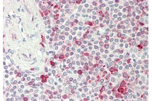 Rabbit Anti-PSAT1 antibody  Formalin Fixed Paraffin Embedded Tissue: Human Spleen Primary antibody Concentration: 1:100 Secondary Antibody: Donkey anti-Rabbit-Cy3 Secondary Antibody Concentration: 1:200 Magnification: 20x Exposure Time: 0. (PSAT1 抗体  (N-Term))