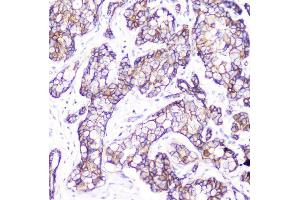 IHC analysis of beta Catenin using anti-beta Catenin antibody (ABIN5693091).