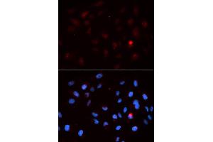 Immunofluorescence analysis of MCF7 cell using Phospho-CDK1-T14 antibody. (CDK1 抗体  (pThr14))