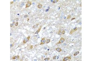 Immunohistochemistry of paraffin-embedded Rat brain using HSPA6 Polyclonal Antibody at dilution of 1:100 (40x lens). (HSPA6 抗体)