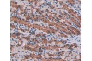 Used in DAB staining on fromalin fixed paraffin- embedded stomach tissue (PTPN22 抗体  (AA 1-256))