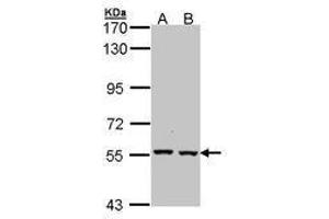 Image no. 1 for anti-Catalase (CAT) (AA 89-311) antibody (ABIN467582) (Catalase 抗体  (AA 89-311))