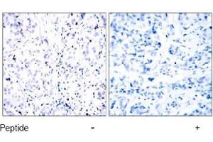 Image no. 1 for anti-Retinoblastoma 1 (RB1) (Ser807) antibody (ABIN197282) (Retinoblastoma 1 抗体  (Ser807))